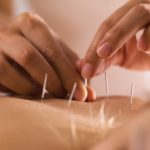 Things You Might Feel After Getting Acupuncture